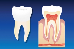 root-canal