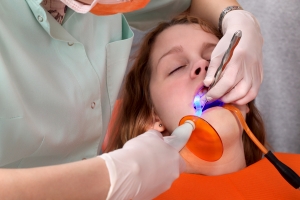 Waterlase Laser Dental Treatment in Oakville ON - Cavity Fillings